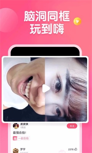 皮皮虾手机版